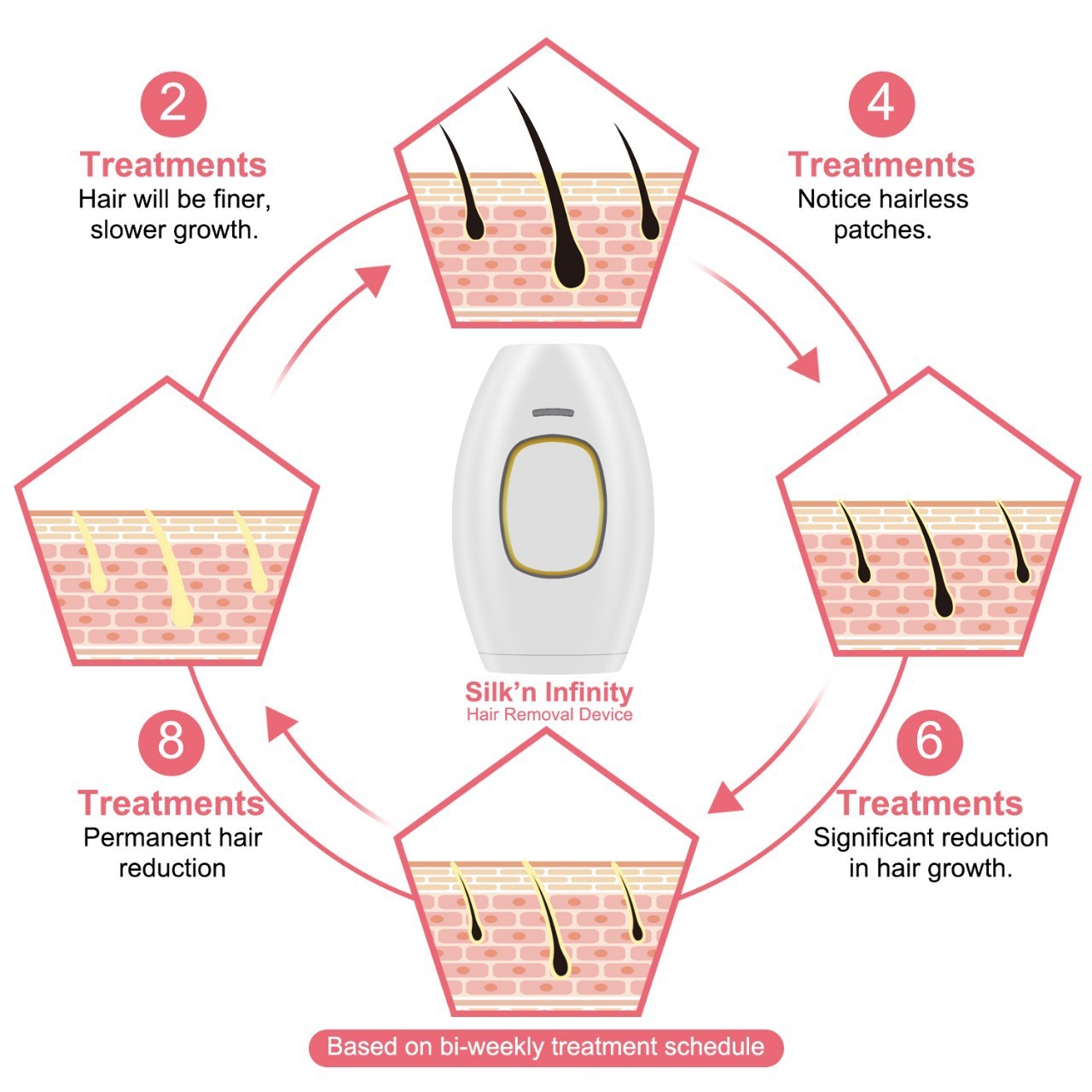 Appareil d'épilation au laser à point de congélation Appareil de beauté portatif pour le visage et le corps entier Appareil d'épilation au laser à photons ipl féminin