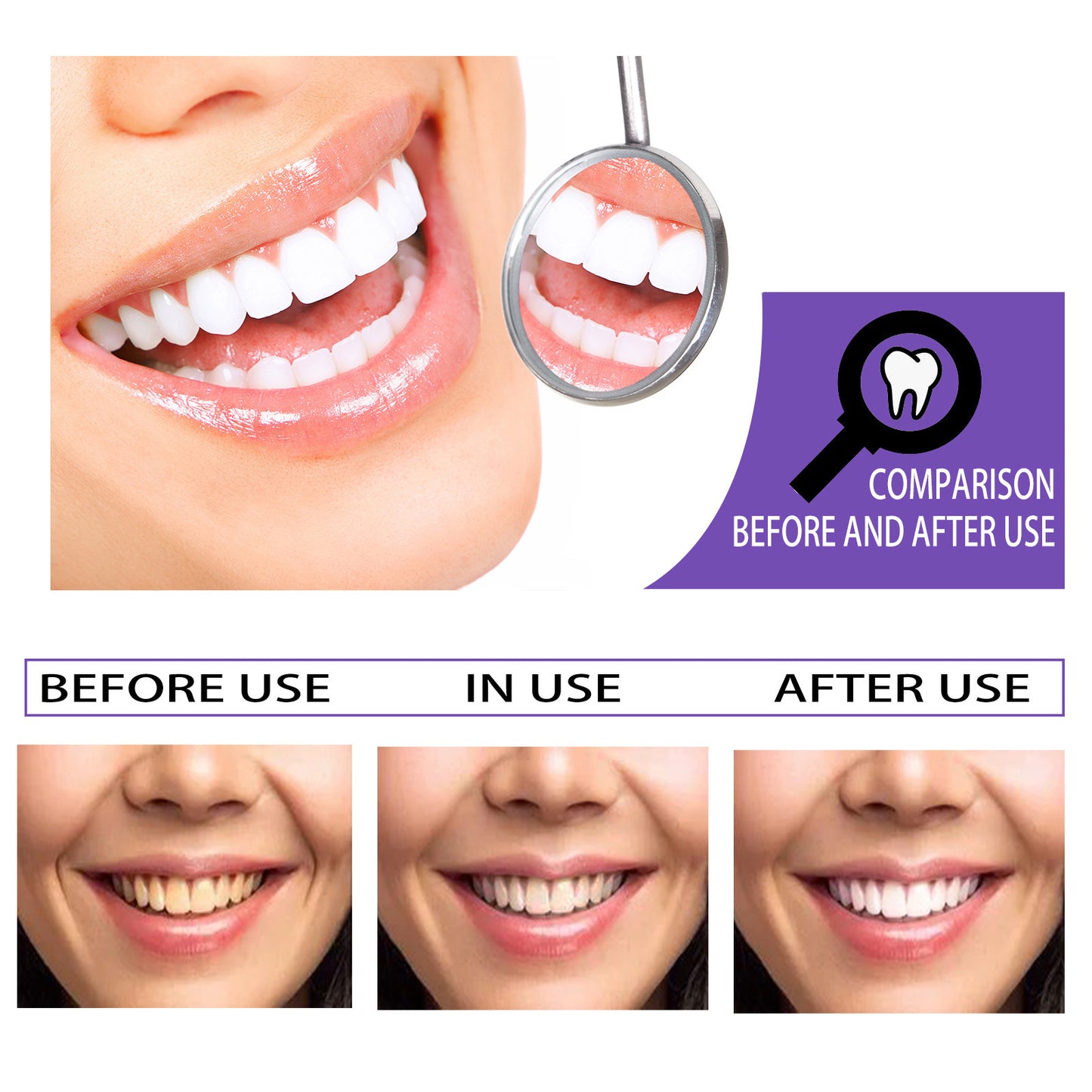 Dentifrice blanchissant les dents, retrait des dents