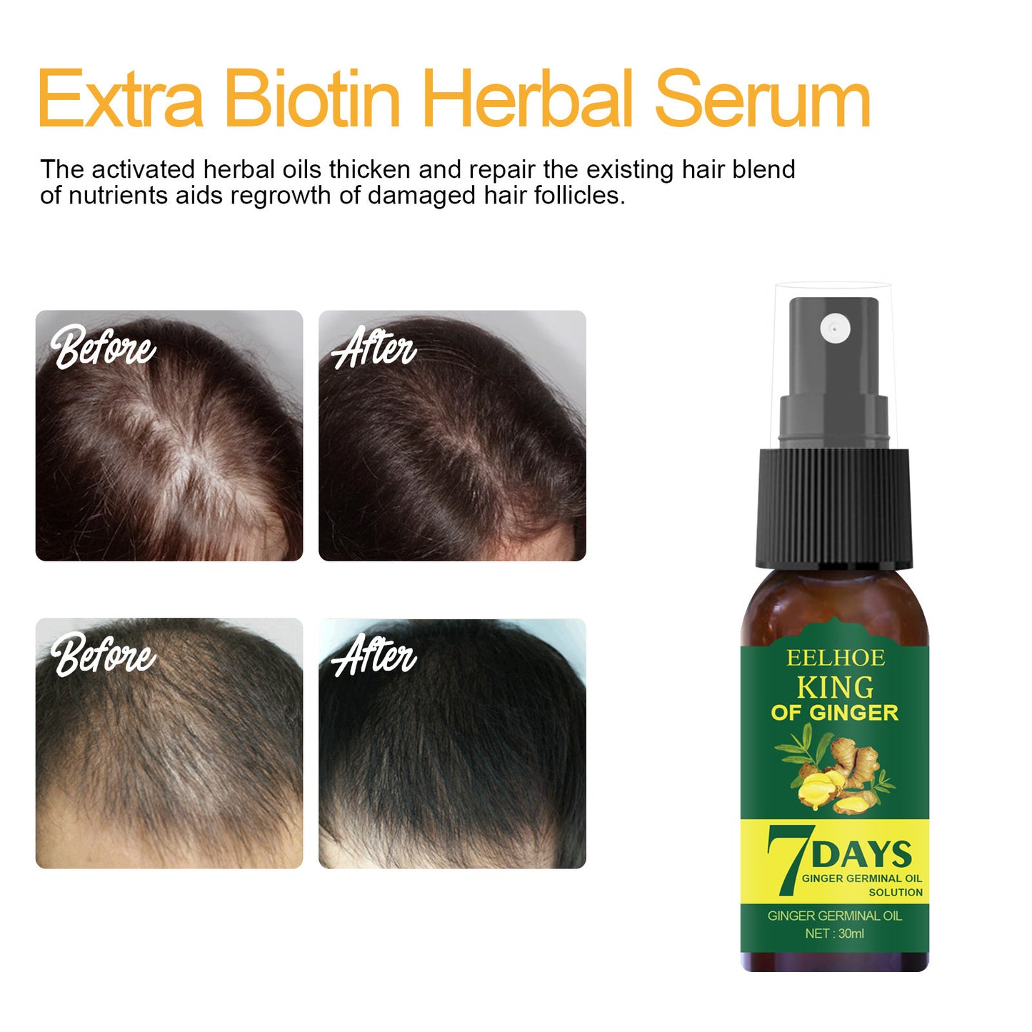 EELHOE commerce extérieur transfrontalier gingembre Nutrition Spray gingembre racine de cheveux Spray hydratant cheveux soin des cheveux Spray
